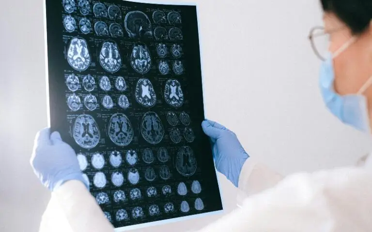 The Value of Attending Outpatient Therapy in Recovery From a Traumatic Brain Injury