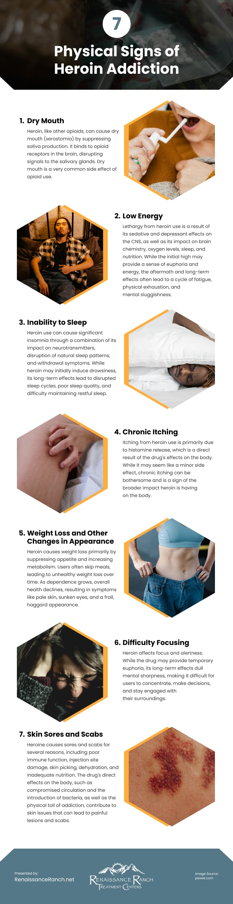 7 Physical Signs of Heroin Addiction Infographic